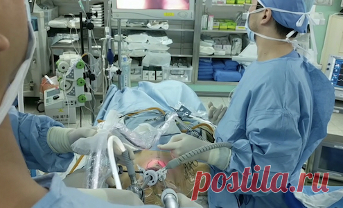 Уменьшение желудка без операции Endozip. Ушивание желудка за рубежом без операции. Бариатрическая трансоральная эндоскопия без разрезов и лечение ожирения в Израиле