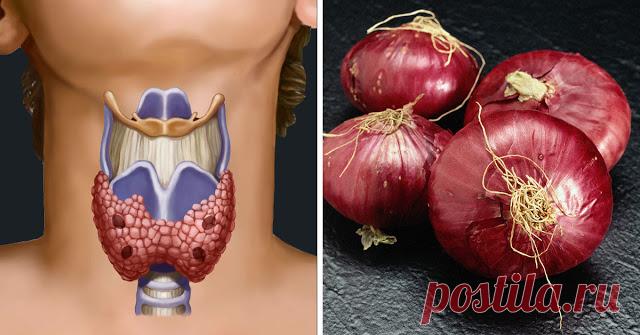 Он поставил луковый компресс на шею. То, что произошло через несколько часов, — поразительно! - 1000