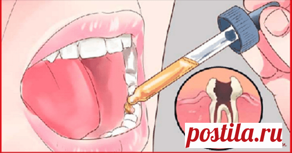 Положите это в рот и зубная боль исчезнет в течение нескольких секунд! — Полезные советы