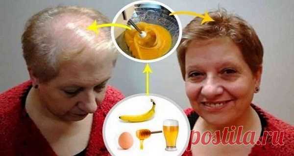 Рецепт для лучшего роста волос: врачи в шоке от его эффекта! Невероятный эффект! Люди, которые страдают от выпадения волос, облысения отчаянно ищут лечения...