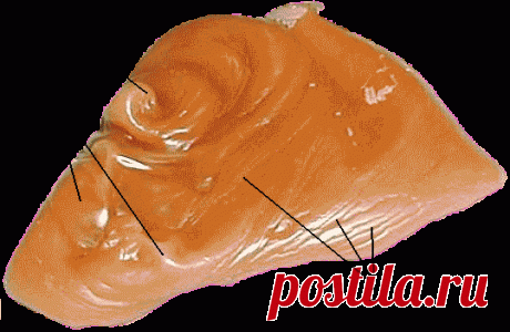 Отливки на воск: Испуг, Невроз, Переживания, Неблагоприятные влияния