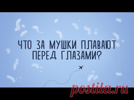 Откуда у нас перед глазами летающие мушки? (2 фото + видео)