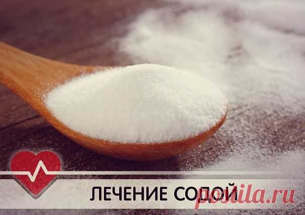 18 РЕЦЕПТОВ ЛЕЧЕНИЯ ПИТЬЕВОЙ СОДОЙ!