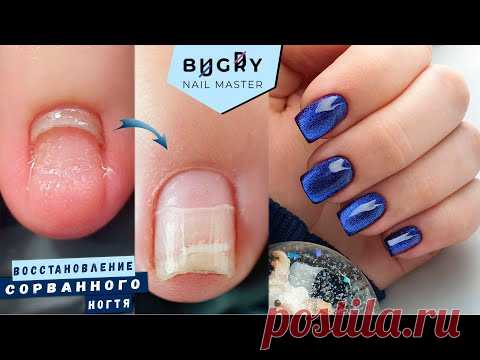 Восстановили СОРВАННЫЙ ноготок / ВВЕРХ растущие ногти Коррекция полигелем / Татьяна Бугрий