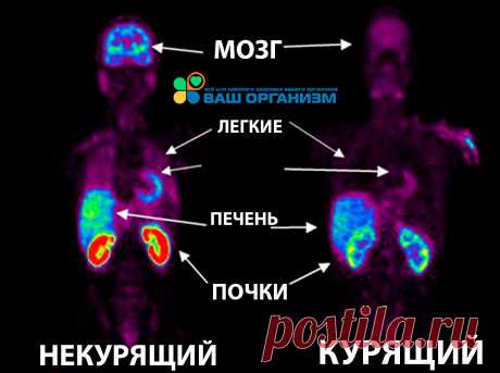 Какие витамины необходимы курильщикам?