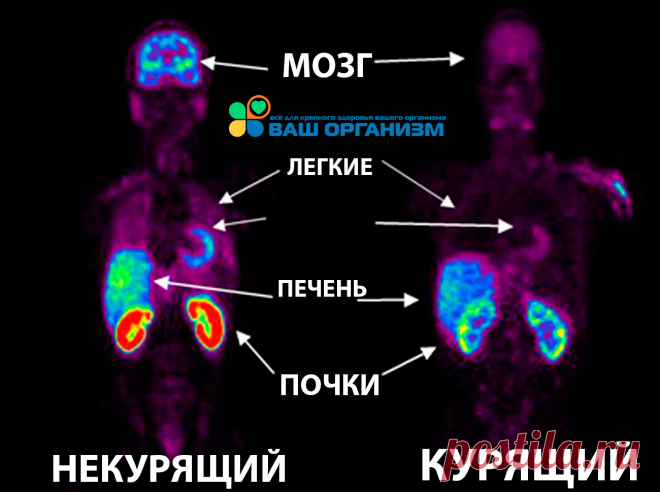 Какие витамины необходимы курильщикам?