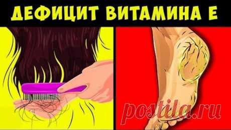 Плохие признаки, что Вашему организму не хватает витамина Е и что делать