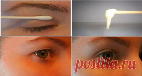 С этой магической маской вы избавитесь от нависшего века за 2 минуты! Старение вызывает множество побочных эффектов, но то, что нам больше всего не нравится это изменения нашей внешности. Годы идут и на лице начинают появляться морщины, и кожа теряет эластичность и упругость, начиная «провисать». Первые признаки старения появляются в области глаз.