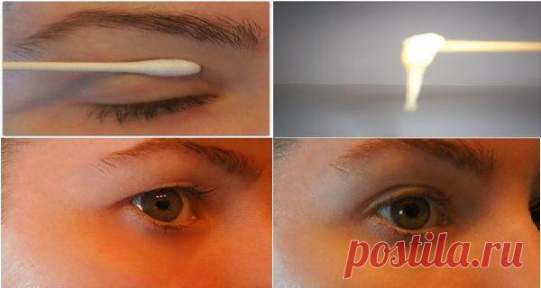 С этой магической маской вы избавитесь от нависшего века за 2 минуты! Старение вызывает множество побочных эффектов, но то, что нам больше всего не нравится это изменения нашей внешности. Годы идут и на лице начинают появляться морщины, и кожа теряет эластичность и упругость, начиная «провисать». Первые признаки старения появляются в области глаз.