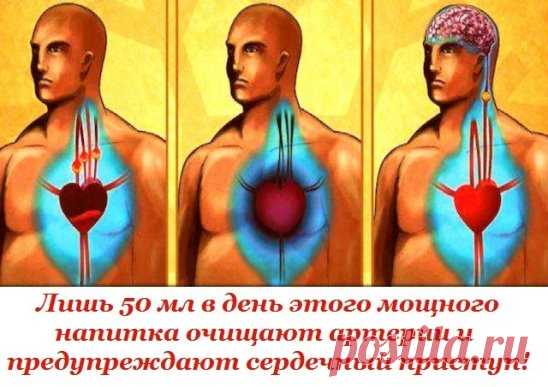 Чистка сосудов чесноком и лимоном