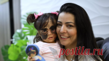 Луне Феннер сделали новую операцию по удалению родимого пятна на лице. Девочке из США Луне Феннер сделали новую операцию по удалению родимого пятна на лице. Читать далее