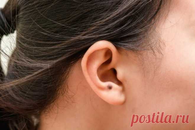 Рак ушной раковины: причины, симптомы, диагностика
Раком ушной раковины или раком уха называют злокачественную патологию, поражающую наружную и среднюю области органа. Развивается примерно с одинаковой частотой и у мужчин, и у женщин. Нередки также случаи развития рака уха у детей до 10 лет. Однако чаще все-таки злокачественная опухоль ушной раковины встречается у пожилых пациентов. Причины развития рака уха Вопрос этот учеными […]
Читай пост далее на сайте. Жми ⏫ссылку выше