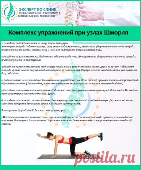 Комплекс упражнений при узлах Шморля