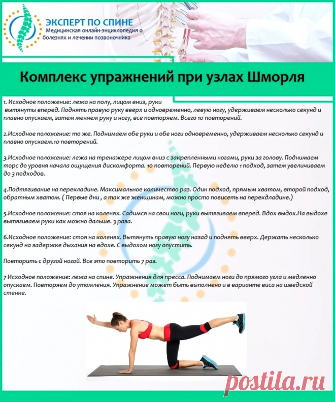 Комплекс упражнений при узлах Шморля