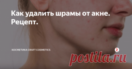 Как удалить шрамы от акне. Рецепт. Это домашнее средство для удаления следов от акне, шрамов и темных пятен. Полностью натуральный рецепт просто приготовить в домашних условиях. Регулярное применение средства на протяжении 3 недель позволяет избавится от шрамов и нежелательной пигментации.
Нутовая мука хорошо очищает и смягчает кожу, так как содержит витамины и аминокислоты.
Куркума содержит активное вещество – куркумин. Оно облада