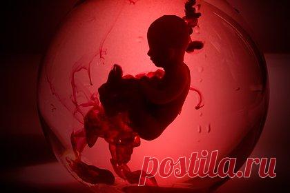 Еще в одном регионе России ввели штрафы за склонение к аборту. Власти Псковской области ввели штрафы за склонение к аборту, сообщает пресс-служба регионального парламента. Максимальный размер штрафа для физических лиц составляет 5 тысяч рублей, для должностных лиц — 20 тысяч рублей, для организаций — 50 тысяч рублей. Ранее похожие штрафы ввели в Калининградской области.