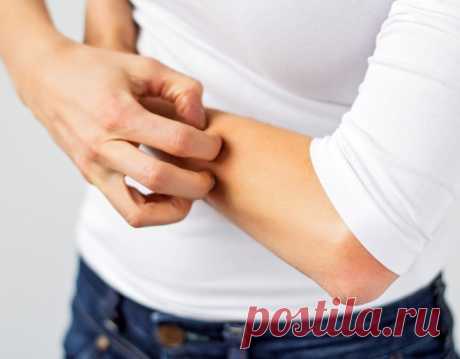 Дерматит — в поисках причин возникновения и эффективного лечение