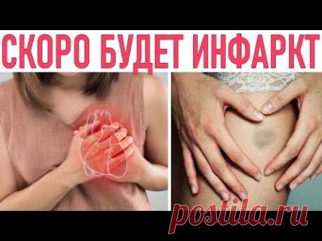 ОПАСНЫЕ СИМПТОМЫ НЕ ПРОПУСТИ | 8 признаков инфаркта сердца о которых молчат врачи