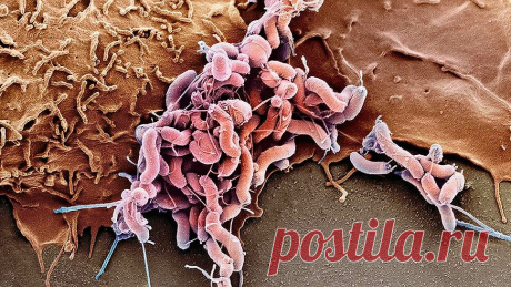 Зачем выявлять H.Pylori | Блог врача-эндоскописта | Яндекс Дзен