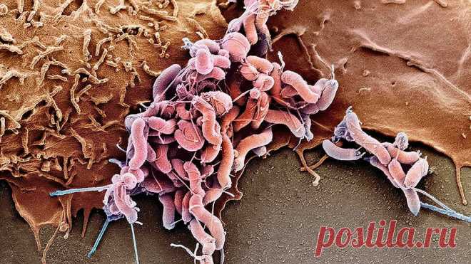 Зачем выявлять H.Pylori | Блог врача-эндоскописта | Яндекс Дзен