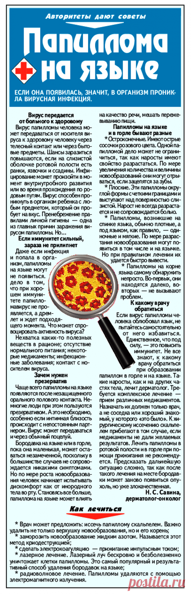 Папиллома на языке