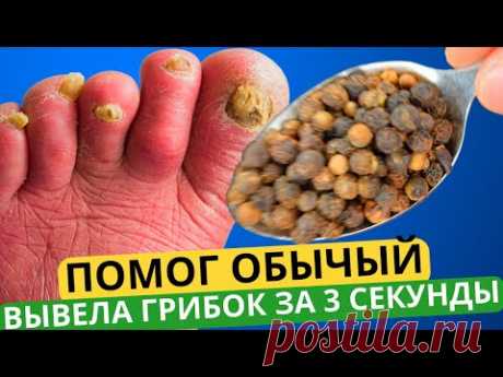 Как я избавилась от грибка ногтей. Самый дешевый способ без таблеток!