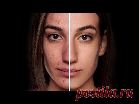ИДЕАЛЬНАЯ Кожа в Фотошопе - ЭТО не ТАК сложно как Ты думал!!