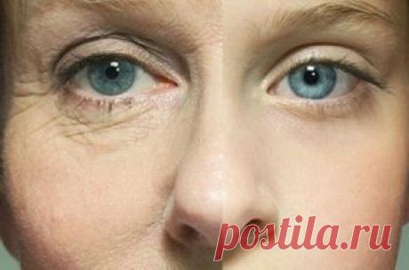 Как убрать морщины вокруг глаз, популярные рекомендации