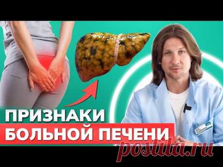 Как ПОНЯТЬ, что ваша ПЕЧЕНЬ не в порядке? / Учимся помогать своей печени при загрязнении
