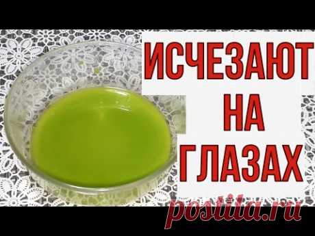 Даже если вам за 60, бесплатное средство от пигментных пятен, дёшево, эффективно