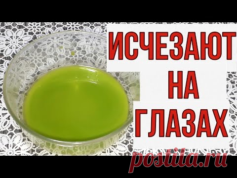 Даже если вам за 60, бесплатное средство от пигментных пятен, дёшево, эффективно