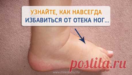 Постоянно отекают ноги к вечеру? Решение есть!