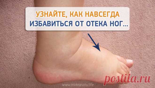 Постоянно отекают ноги к вечеру? Решение есть!