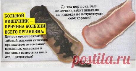 У вас около 9 кг ЯДОВ в прямой кишке — вот что Вы можете сделать!