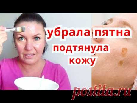 ЧУДО МАСКА  УБРАЛА ПИГМЕНТНЫЕ ПЯТНА  / Отбеливание кожи и подтяжка лица