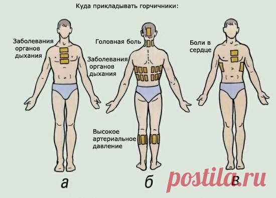 Как правильно ставить горчичники