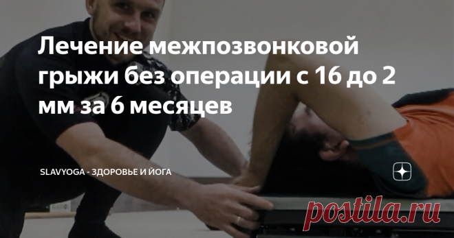 Лечение межпозвонковой грыжи без операции с 16 до 2 мм за 6 месяцев Друзья, всем привет! Помните Пашу с грыжей 16 мм L5-S1 с абсолютным стенозом позвоночного канала? Его хотели прооперировать, но я взял его под своё наблюдение.

На днях было сделано контрольное КТ, можете посмотреть результаты в моём новом видео 