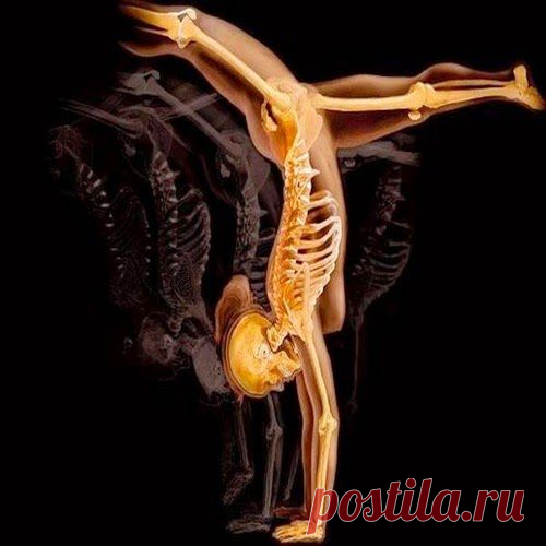 Чтобы кости были здоровы | Друг пенсионера
Миллионы россиян страдают болезнями костной системы. А такой недуг, как остеопороз, среди неинфекционных заболеваний прочно уселся на четвертой ступеньке после заболеваний сердечно-сосудистой системы, онкологичес­ких патологий и сахарного диабета.