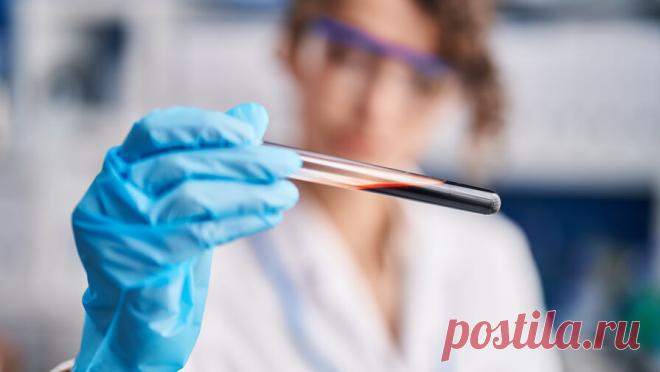 Прибывающих из Чехии россиян начали тестировать на гепатит. Роспотребнадзор на фоне вспышки в Чехии желтухи начал всех прибывающих из этой страны россиян тестировать на гепатит. Об этом сообщает Life со ссылкой на SHOT. В материале отмечается, что риски завоза желтухи из стран Евросоюза есть, но ...