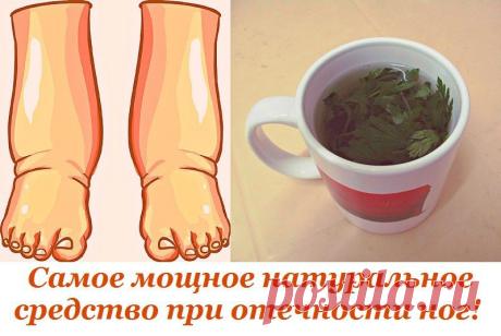 Лечим отечность ног