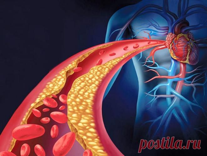 Как почистить закупоренные артерии с помощью питания Артерии являются основой кровеносной системы, переносят кровь от сердца к внутренним органам, головному мозгу человека.