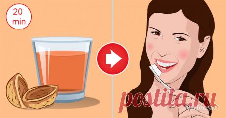 Доступное домашнее средство от зубного налета. Альтернатива чистке в клинике!