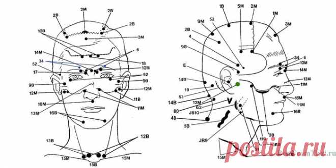 Акупунктура и акупрессура активных точек головы