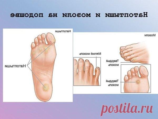 9 полезных применений камфорного масла | экономъ | Яндекс Дзен