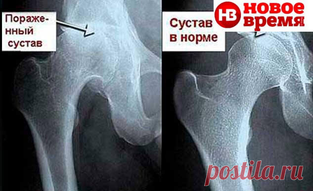 Спасите свои жизни!