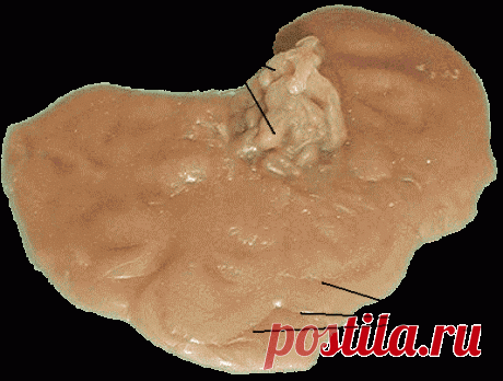 Отливки на воск: Наведение преднамеренной порчи