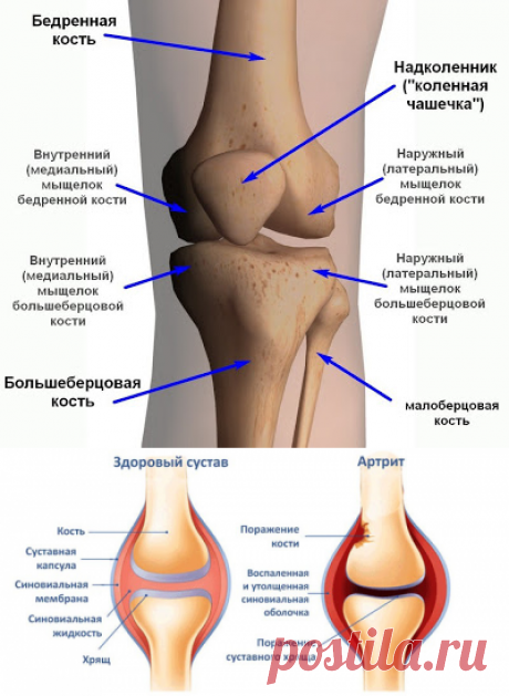 Боли в коленях: лечение народными средствами