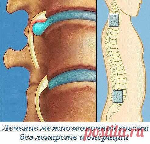 (50) Одноклассники
