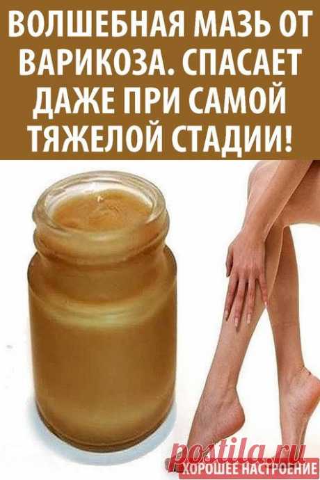 Волшебная мазь от варикоза. Спасает даже при самой тяжелой стадии!
Можно попробовать такой способ лечения