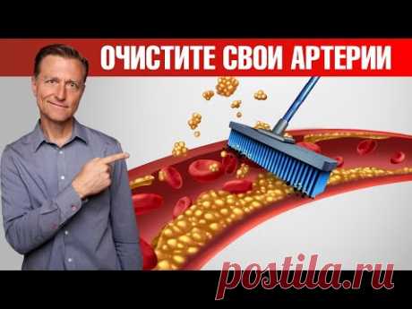 Бляшки в сосудах? Лучший обед для сердечно-сосудистой системы👍